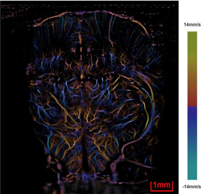 The New Generation Ultrasound “Microscope”! A team from Nanjing ...