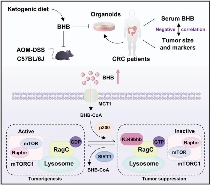 RagC senses β-hydroxybutyrate abundancy to suppress mTORC1 and tumor growth