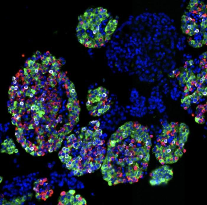 Human islet function, diabetes risk defined by heterogeneous endocrine ...