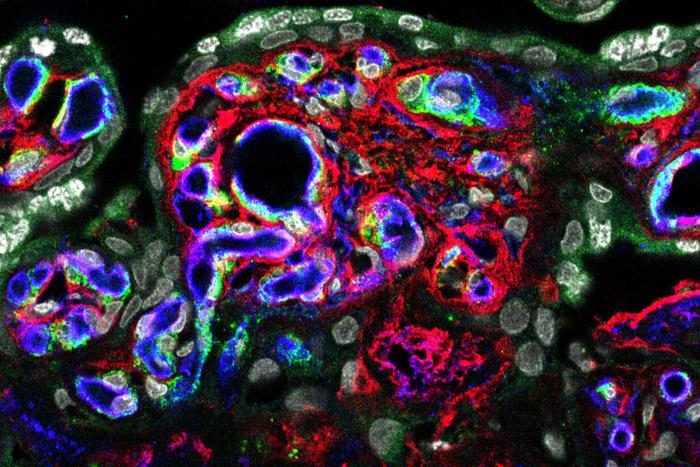 Placental protein may offer clues to early brain development