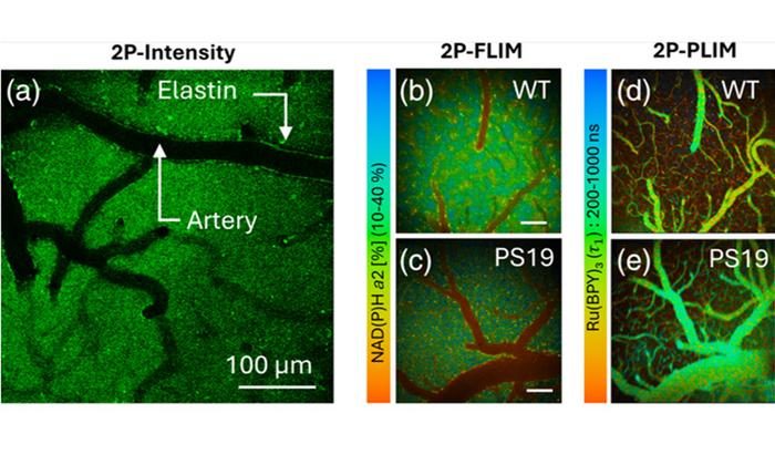 Optical imaging links altered metabolism and oxygen use in Alzheimer’s disease