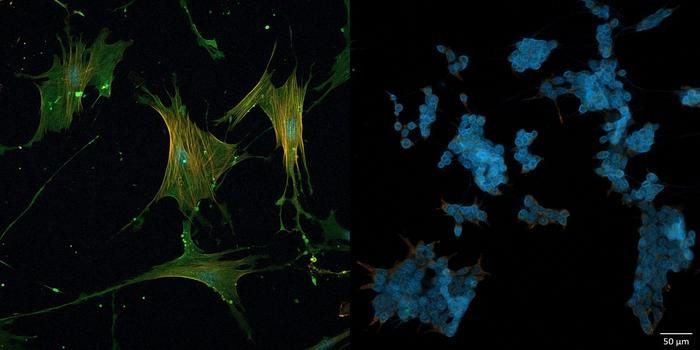 Pancreatic cancer: Researchers reprogram the tumor microenvironment