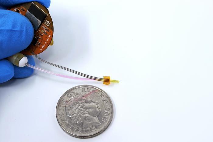 Le MIT crée l'implant LUCID pour aider à prévenir la récidive du glioblastome