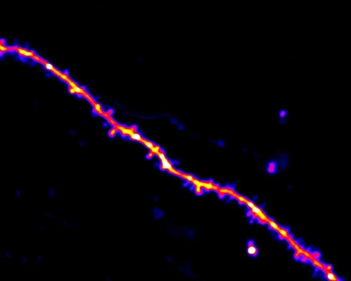 Dendrite image