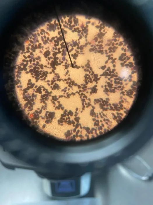 Yeast cells under microscope