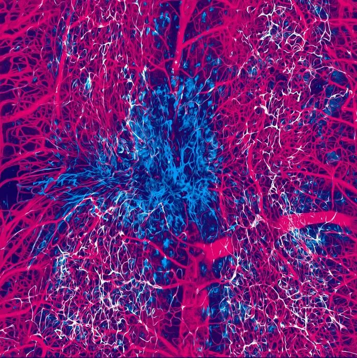 Pericytes-vasculature-lesionsite-Tedeschi-OhioStateUniversity
