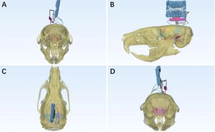 The integrated 3D atlas included brain tissue functional regions, cerebral arteries, the BCI device, and cranial tissue.