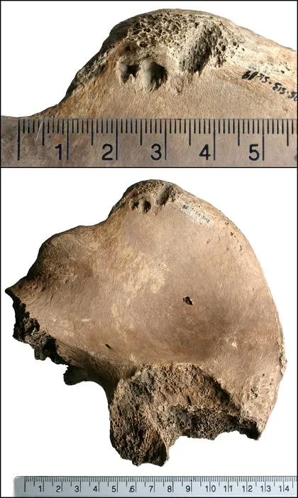 Lesion on the right ilium of 6DT19