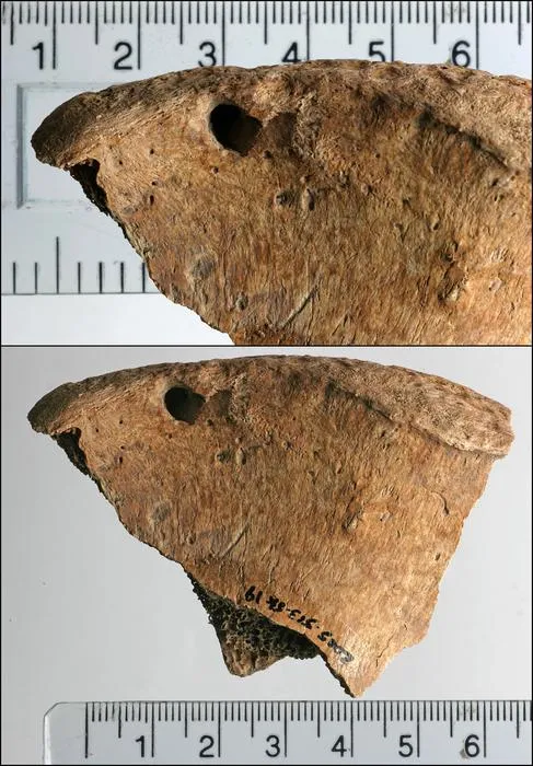 Lesions on the left iliac spine of 6DT19