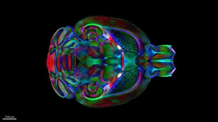 Duke Mouse Brain Atlas Will Accelerate Studies of Neurological Disorders