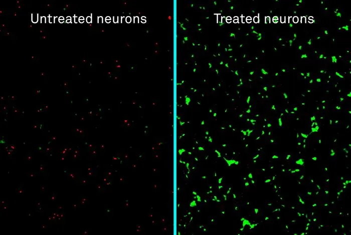 Treated v. untreated human neurons