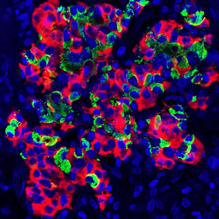 Human islets grown in the immune-remodeled spleen of macaques