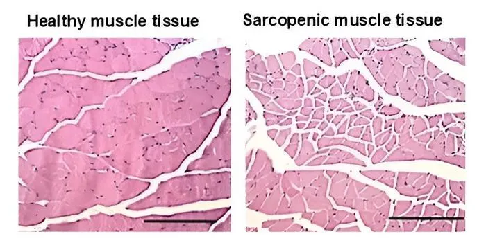 Healthy and sarcopenic muscle tissue