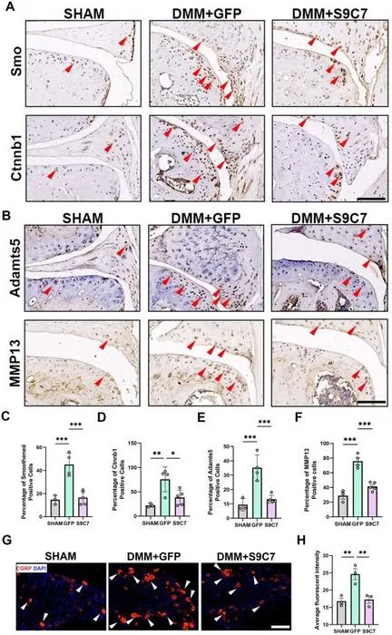 CasRx-mediated gene knockdown decreased OA-associated factors in tissues.