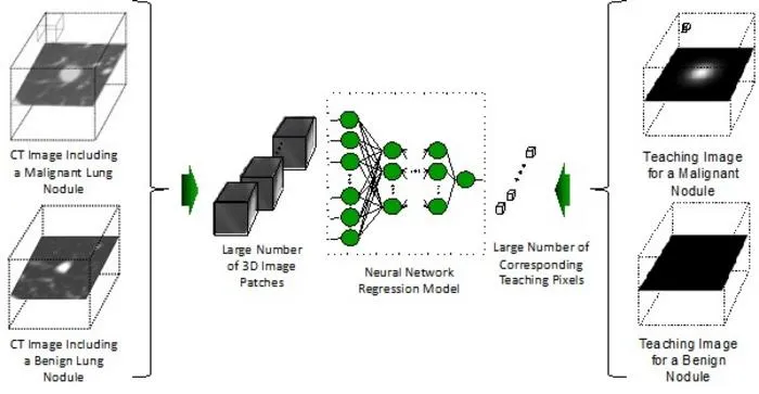 Ultra-lightweight artificial intelligence model for efficient cancer diagnosis.