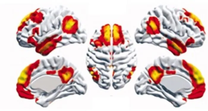 Representation of the connectivity strengths within the brain's Default Mode Network