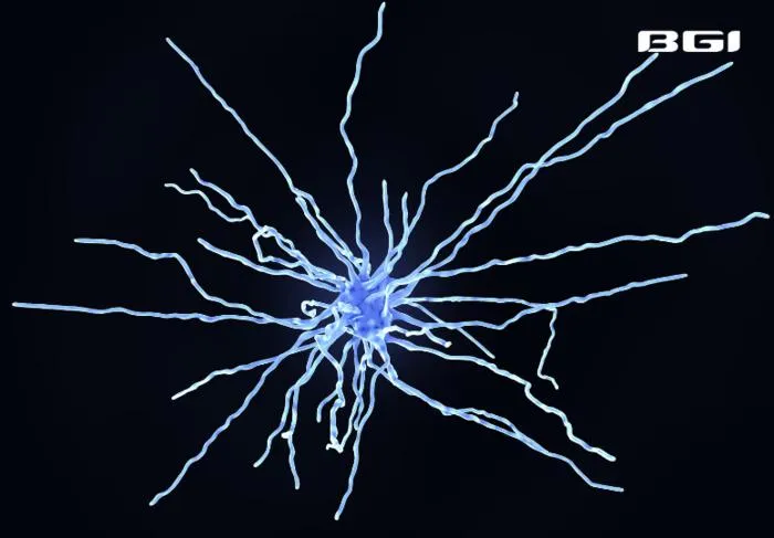 BGI Genomics Study Uncovers Brain Damage Progression in Alzheimer's Disease