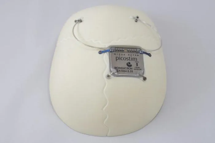 Picostim neurostimulator on skull