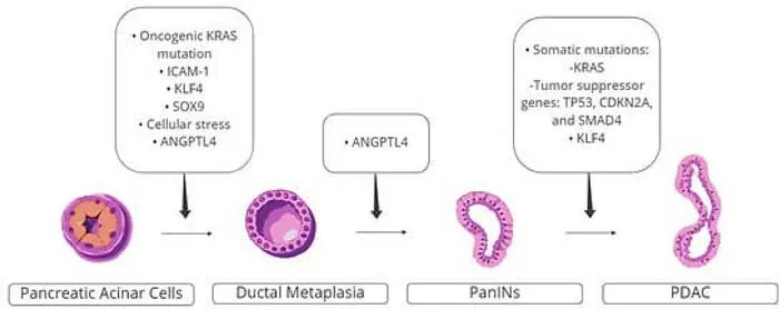 Pancreatic cancer pathways