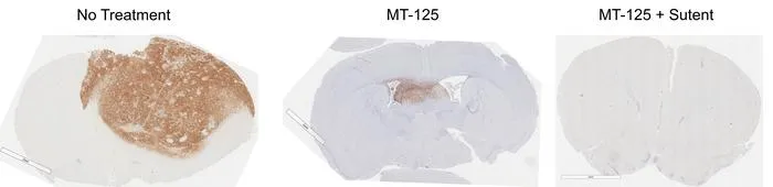 MT-125 and Sutent synergize to attack brain tumors