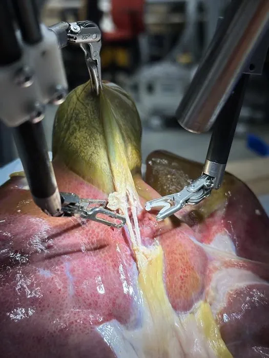 Surgical Robot Transformer-Hierarchy performs surgery
