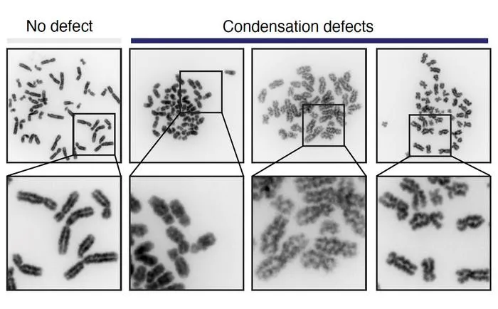 Chromosomes with condensation defects