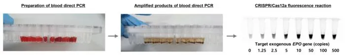 [Figure 3] The actual process of blood direct PCR and an example of when they are detected and visually confirmed.