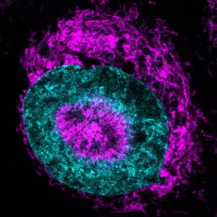 Confined cancer cells