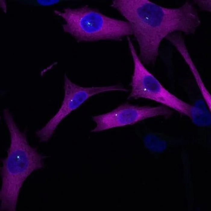 Melanoma cells