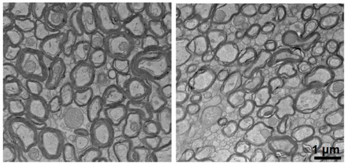 Lithium deficiency thins myelin sheaths
