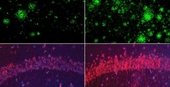Lithium deficiency vs. normal lithium levels