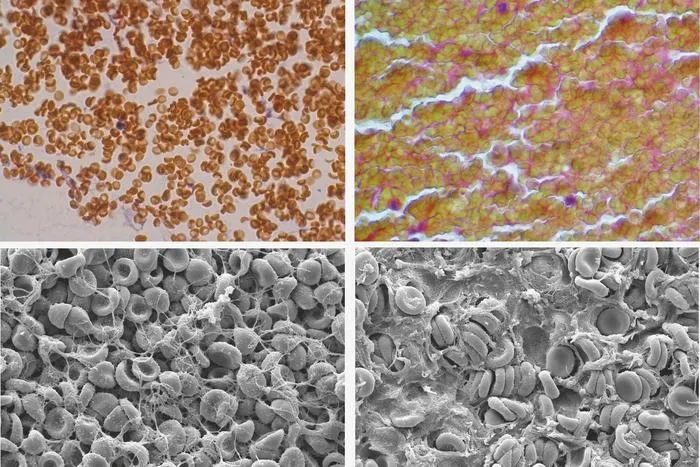 Blood Clotting in the Absence of Platelets