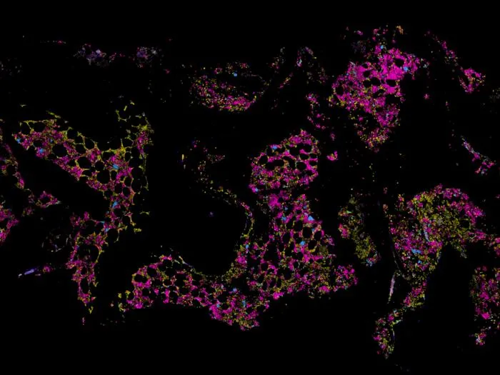 Bone marrow map