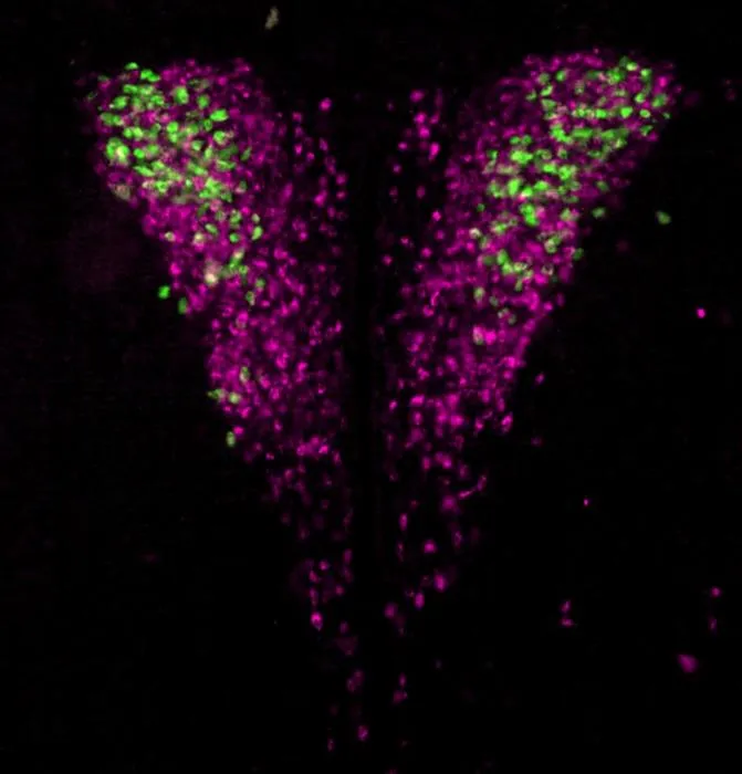 Spotted – Neurons