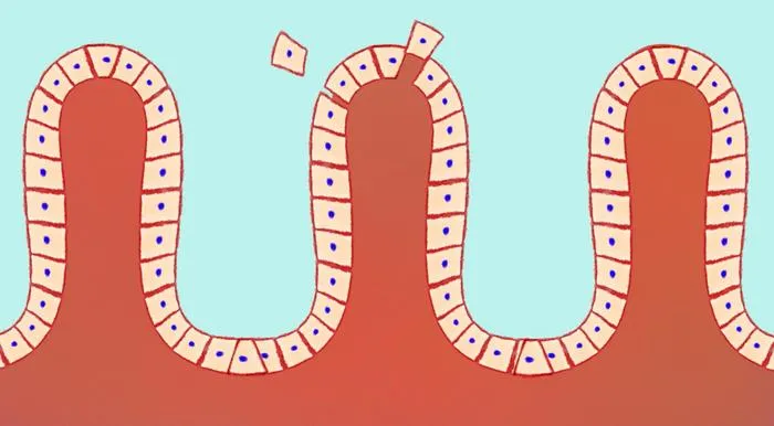 Shedding of intestinal surface cells