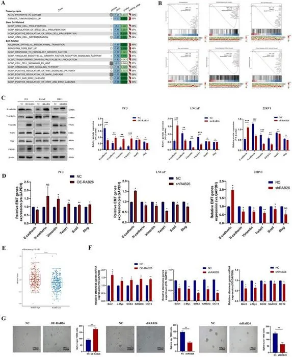 RAB26 promotes epithelial–mesenchymal transition and stem cell-like characteristics of prostate cancer cells.