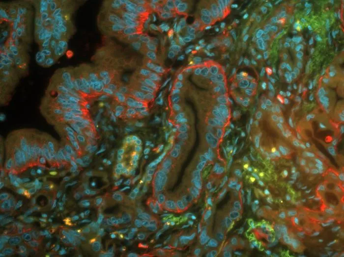 Human pancreatic cells
