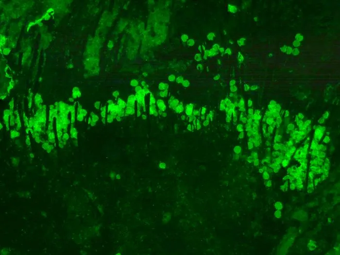 Fig. 5: Fluorescent fossil pollen on the body of the fossil bumble bee Bombus (Kronobombus) messegus (Fig. 4).