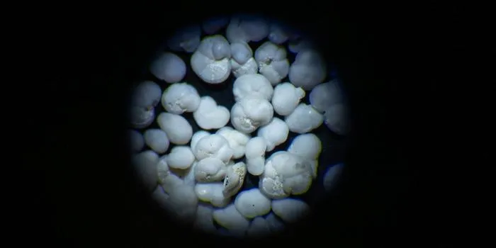 foraminifera under microscope - credit Kaitlin Prince, UMass Boston