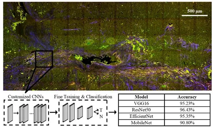 Label-free multiphoton microscopy and deep learning can be used in combination to classify pancreatic neuroendocrine neoplasms with high accuracy—a significant step toward automated digital pathology for such tumors.
