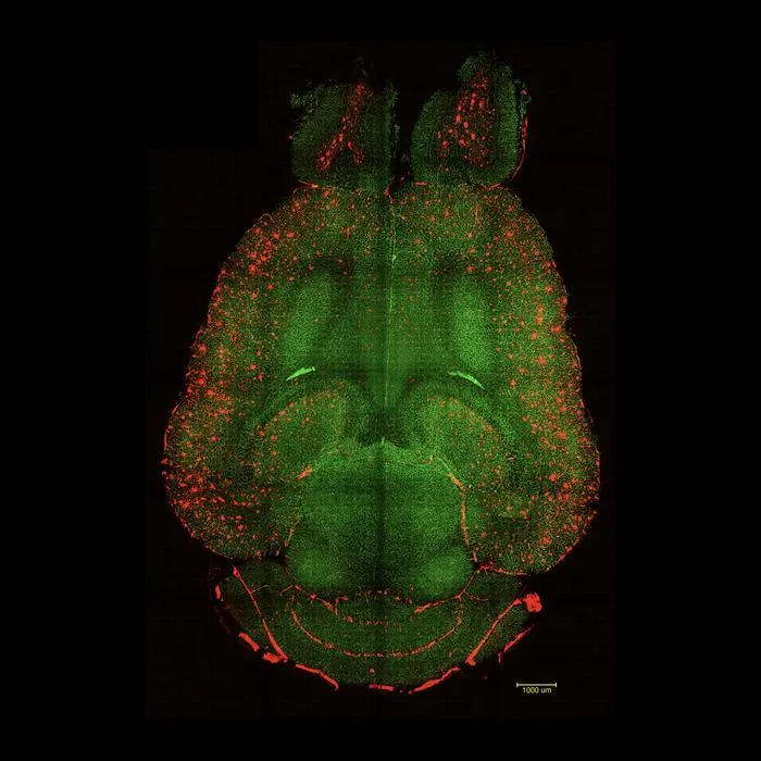 Mouse brain NOT treated