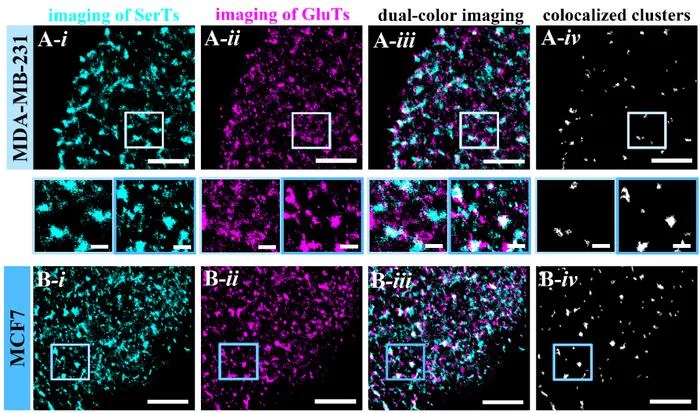 Figure 3. Compared analysis of the assembly and co-localization of SerTs and GluTs on MCF7 and MDA-MB-231 cells.