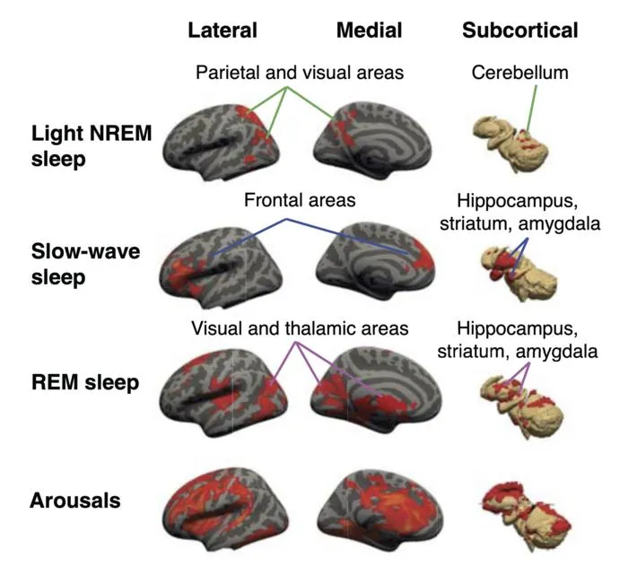 Sleep stages and brain activity