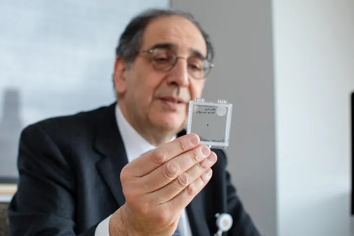 José-Alain Sahel, M.D., holding the PRIMA implant