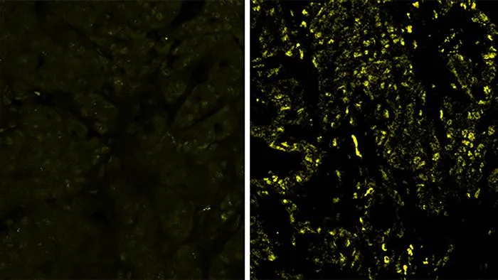 Estrogen receptor alpha expression