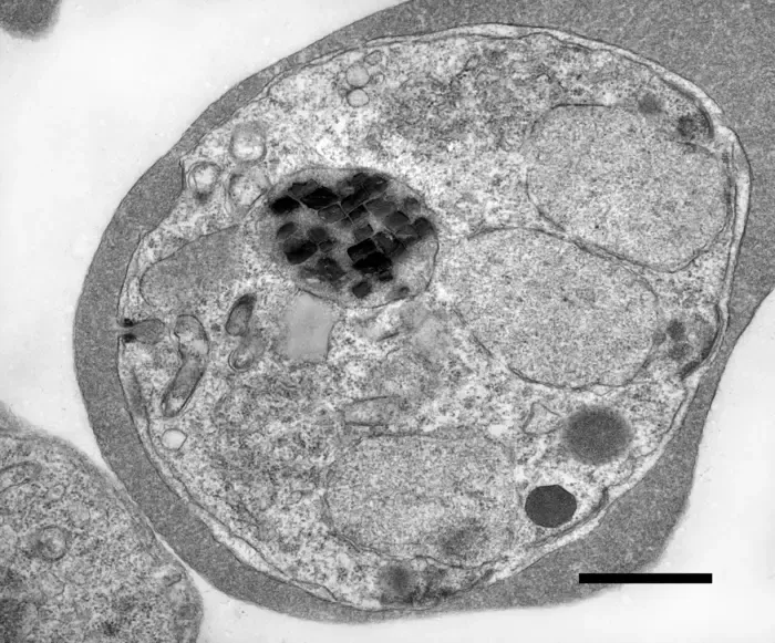 EM malaria parasite
