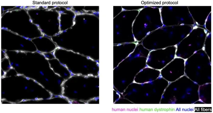 Muscle tissue regeneration
