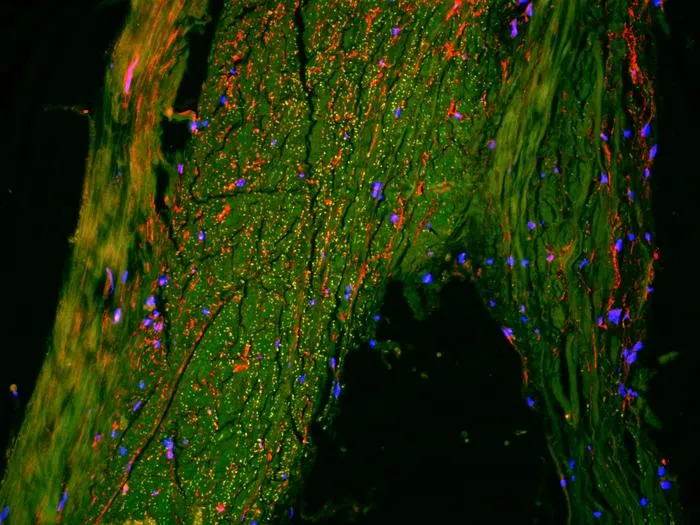 The Brain's Drainage Area.