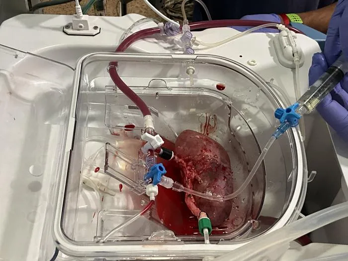 Porcine kidney