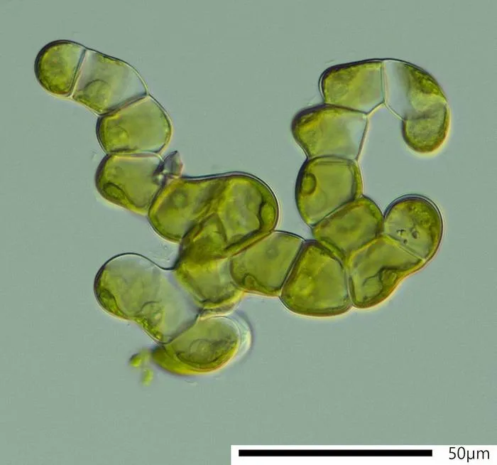Image showing the branched filaments of the alga Coleochaete, an intriguing group which has evolved more elaborate disc-shaped bodies. These images were made using “light micrograph”, meaning they were captured via a microscope.